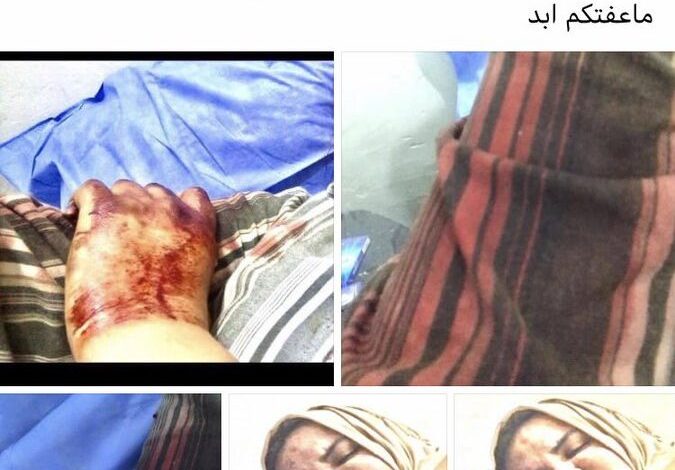 صورة محاولة اغتيال المسعفة انتصار ناهي وإصابتها برصاص مسدس كاتم